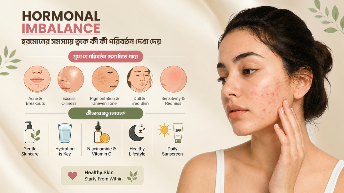 Hormonal imbalance-এর কারণে acne, oily skin, pigmentation ও sensitive skin দেখানো minimal skincare concept illustration।