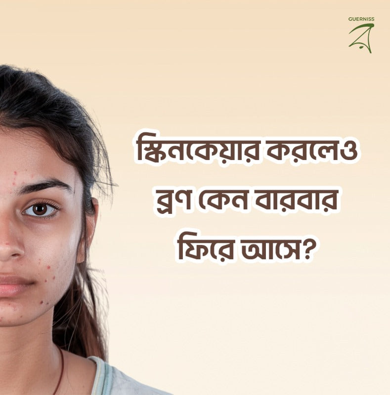 স্কিনকেয়ার করলেও ব্রণ কেন বারবার ফিরে আসে?