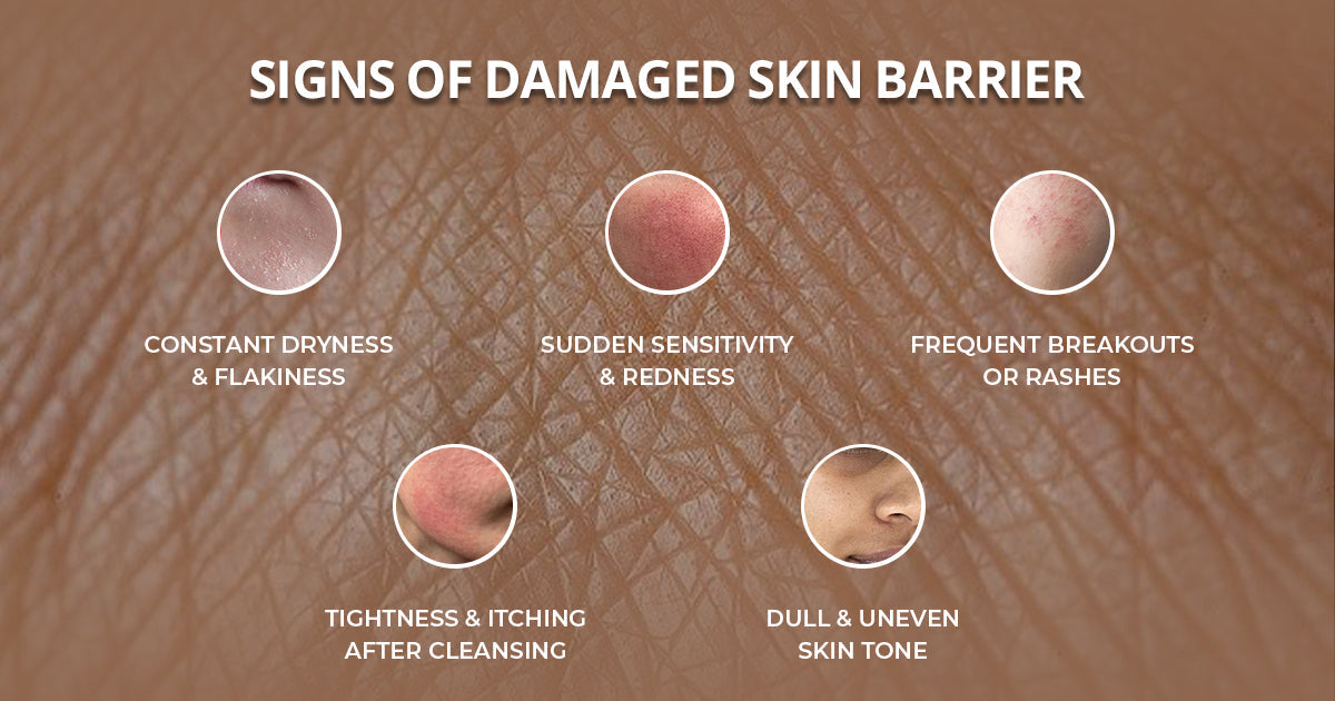 আপনার ত্বকের সুরক্ষা দেয়াল (Skin Barrier) নষ্ট হওয়ার ৫টি লক্ষণ এবং মেরামতের উপায় 