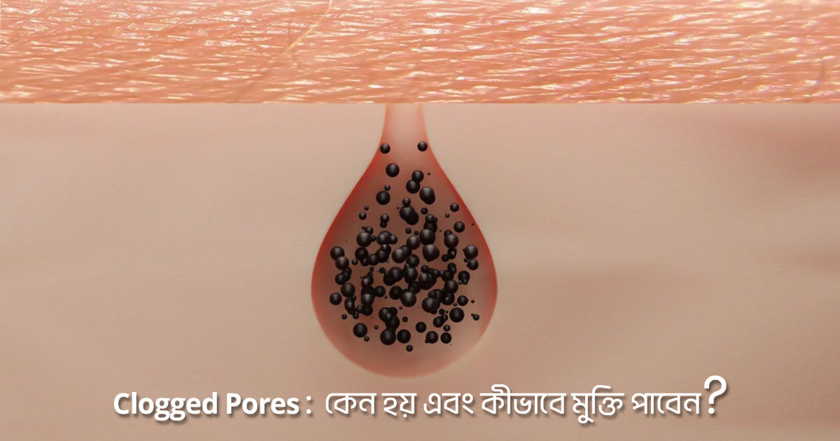 Clogged Pores: Why do they happen and how to get rid of them?